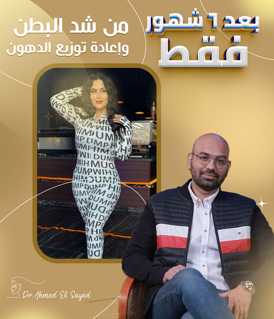 شد-ترهلات-البطن